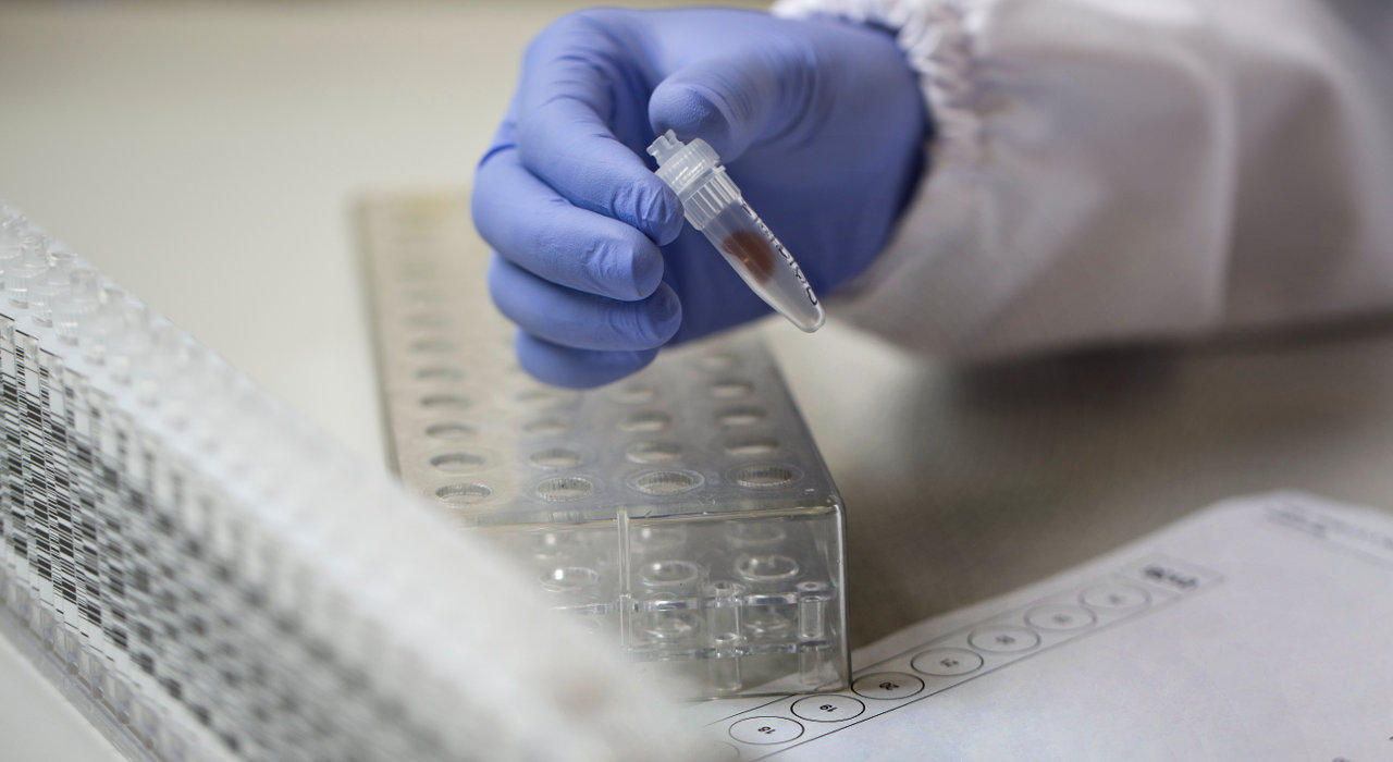 Mão de funcionário de laboratório com luvas pega em amostra de sangue com folha à sua frente