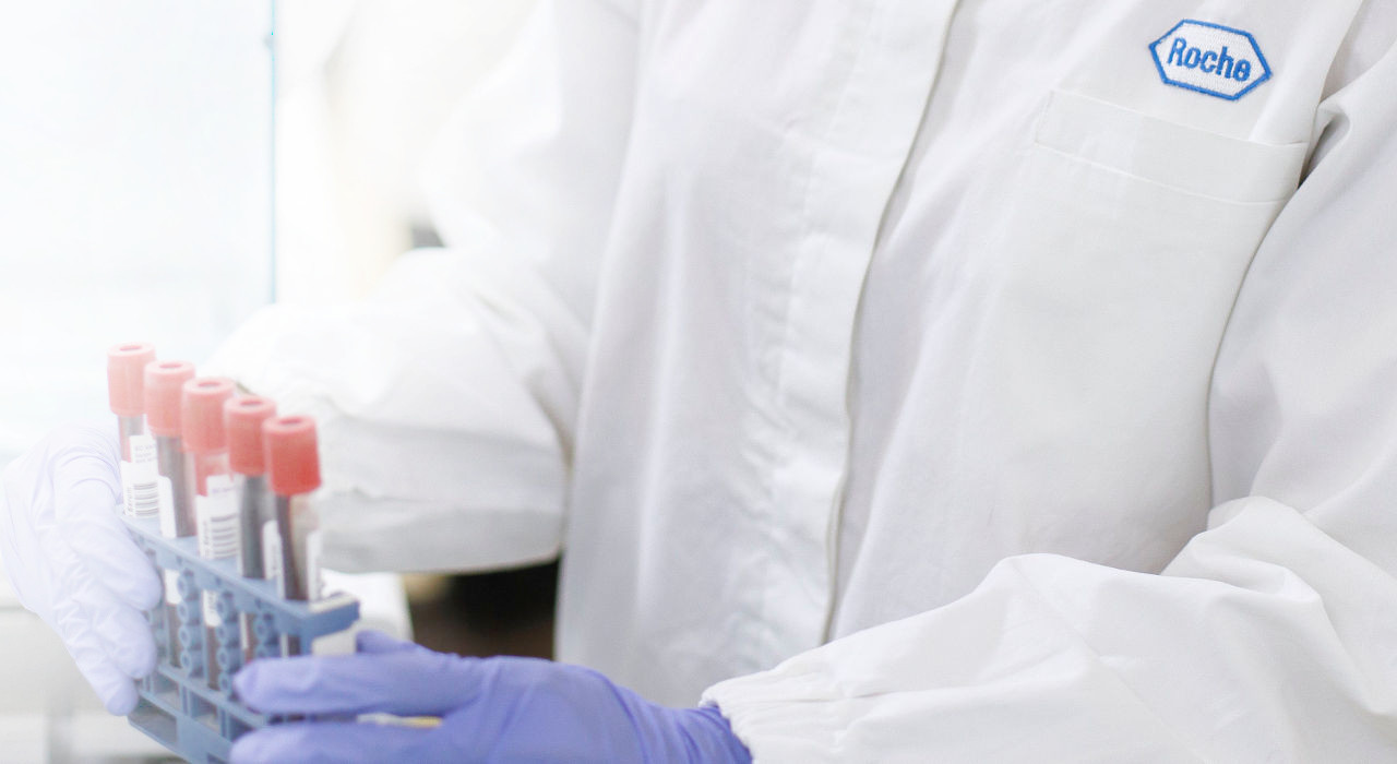 Funcionário de laboratório segura tubos de análise com amostras de sangue